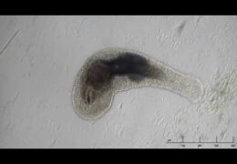 Macrostomum Eating a Rotifer