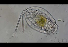 Rotifer Evacuating