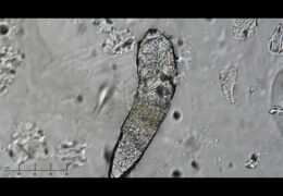 Demodex – Microscopic Mites Living On Your Face