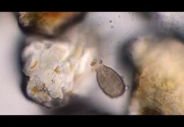 Marine Foraminifera amongst grains of sand