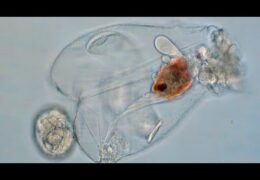 Rotifer – Epiphanes sp