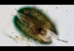 Inside a Freshwater Ostracod