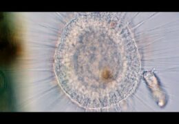 Rotifer Tangled Up with a Heliozoan