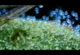 Peritrichs on a Duck Weed Leaf